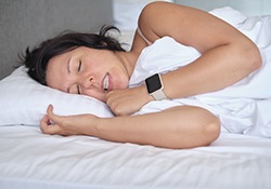 Woman asleep in white sheets grinding her teeth