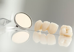 Dental crowns & bridges