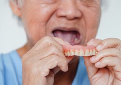 An older woman removing her dentures