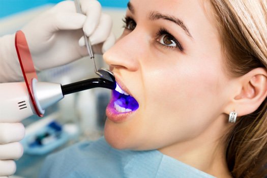 UV light applied to woman’s tooth-colored filling