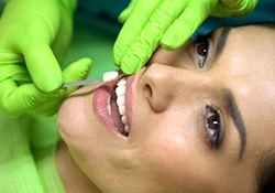 dentist placing a veneer on a patient’s tooth 
