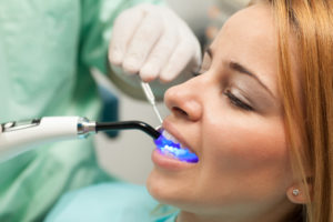 Portrait of young woman at dentist's office replacing fillings. Side view. Close up.