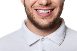 smile with missing tooth