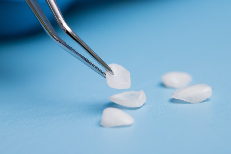 veneers being picked up by a set of tweezers